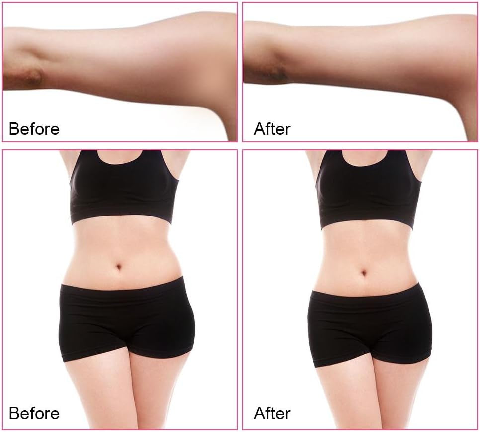 Professional RF Body Contouring and Fat Cavitation Machine for Skin Tightening and Cellulite Reduction (UK Plug)
