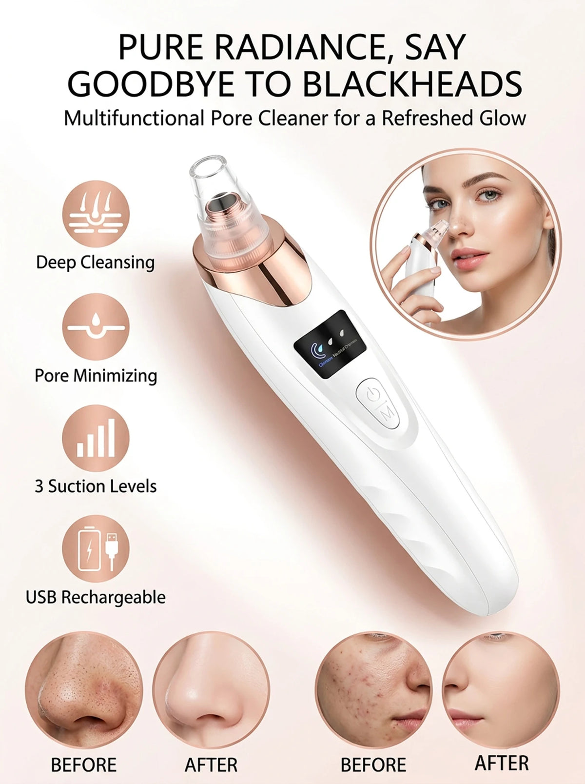 USB Rechargeable Facial Pore Cleanser and Exfoliator