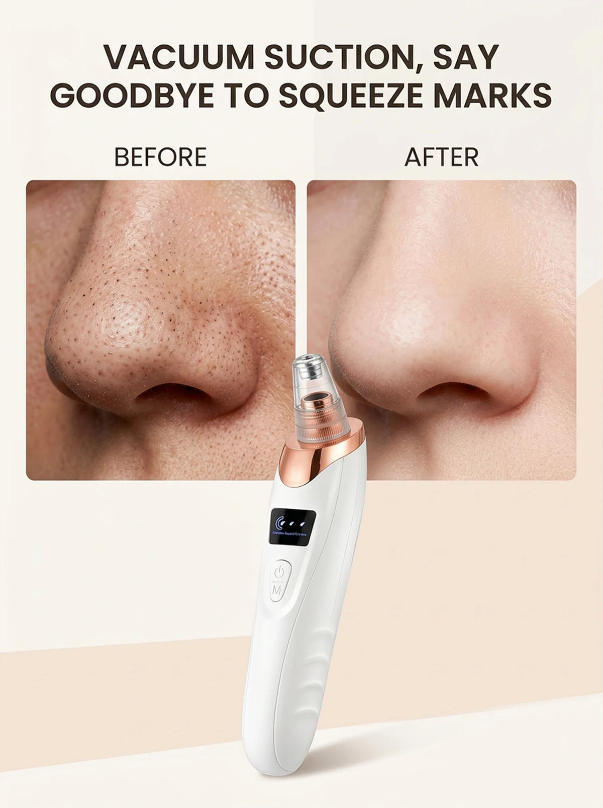 USB Rechargeable Facial Pore Cleanser and Exfoliator