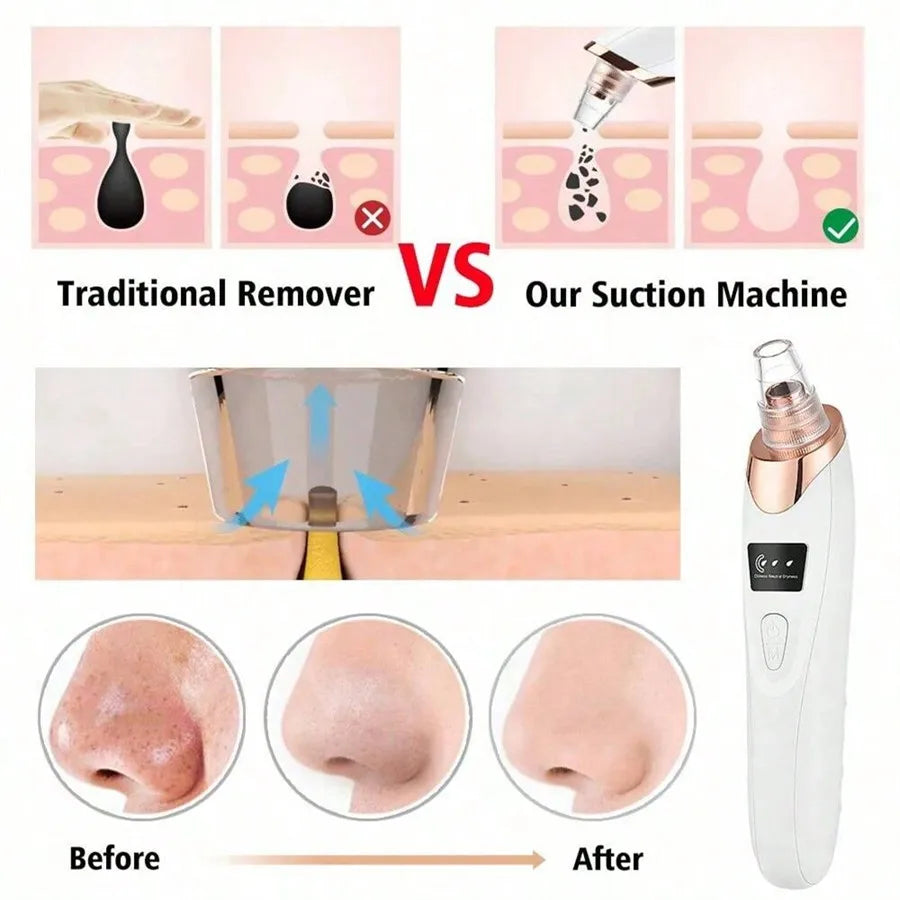 USB Rechargeable Facial Pore Cleanser and Exfoliator